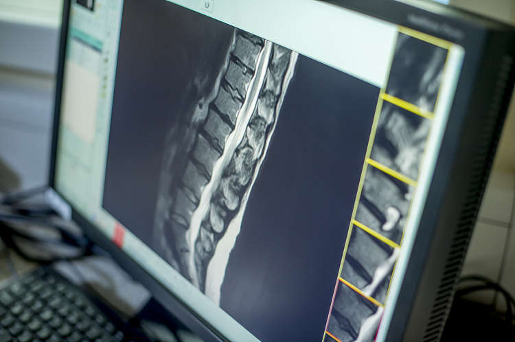 MRI Spine scan