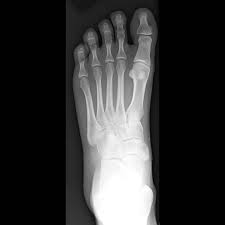 Imaging Foot