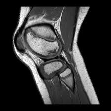 Imaging Knee